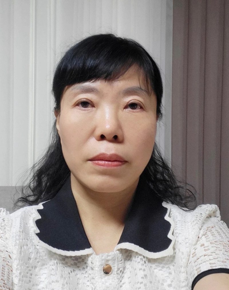 리프팅 셀카 후기 3 — 흰 칼라 블라우스 중년 여성 셀카
