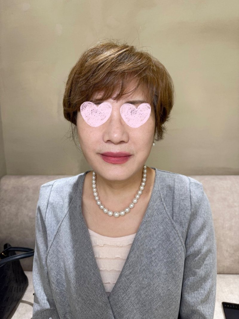 리프팅 셀카 후기 5 — 회색 재킷 여성 셀카