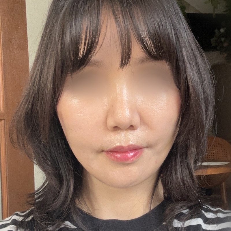 리프팅 셀카 후기 7 — 앞머리 단발 여성 셀카